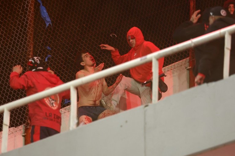 Violences entre supporters en Argentine: 19 blessés dont 3 graves