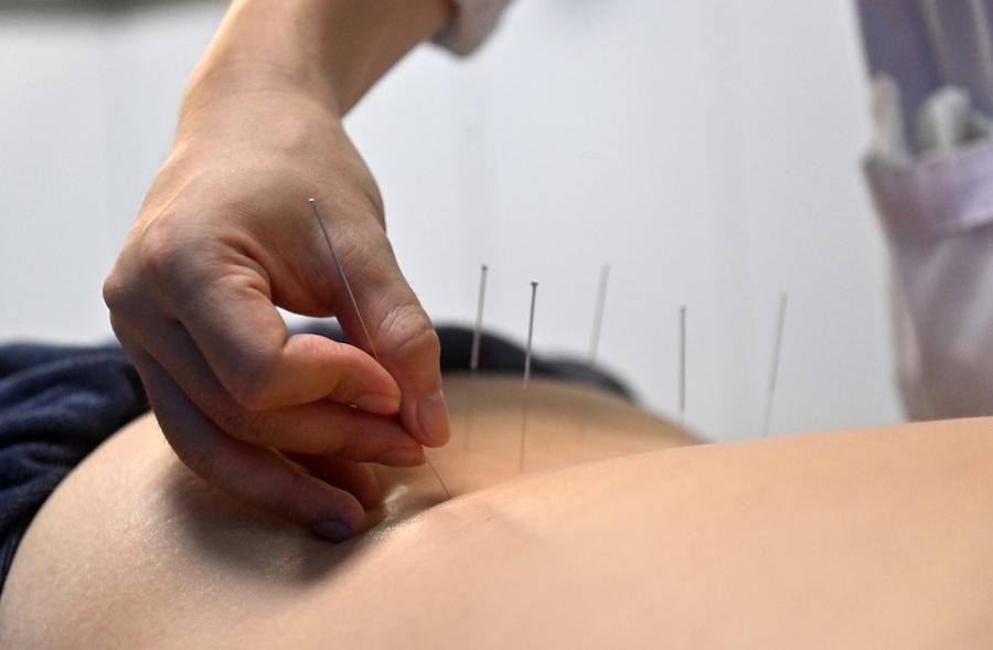 Un médecin français libéré de sa douleur grâce à la médecine traditionnelle chinoise